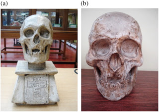 Fig. 2. (a) The cast of Robert Bruce's skull used for manual measurement of width and length (b) The cast of Robert Bruce's skull used for magnetic resonance imaging measurement 